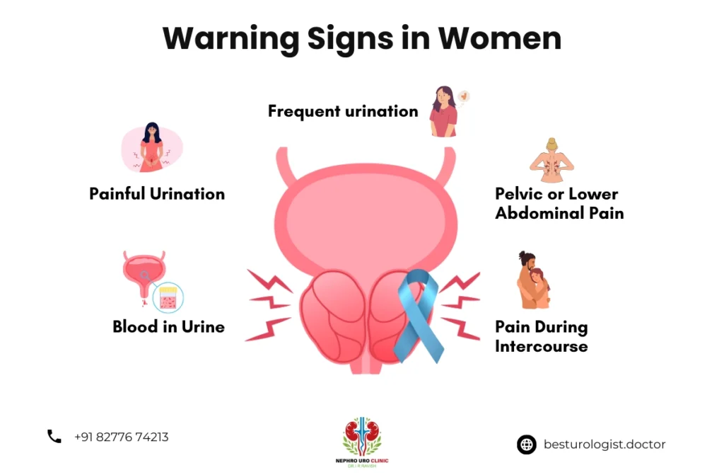 Symptoms of Prostate Cancer in Women