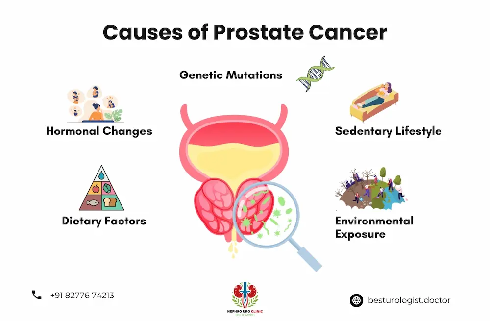 Prostate Cancer Treatment in Bangalore