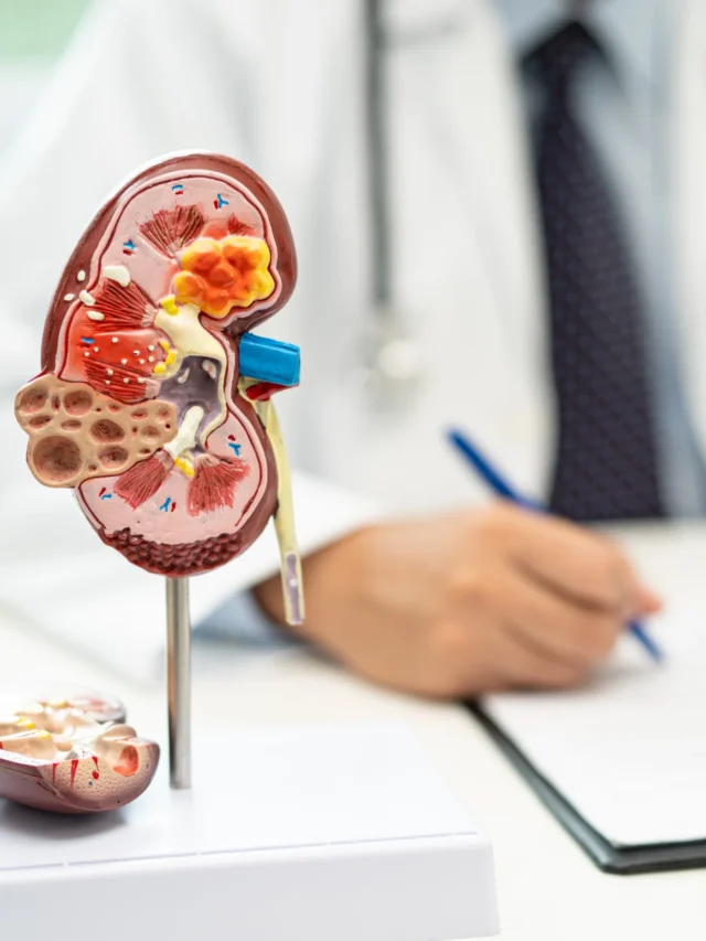 Early Signs of Kidney Stones