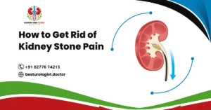 How to Get Rid of Kidney Stone Pain