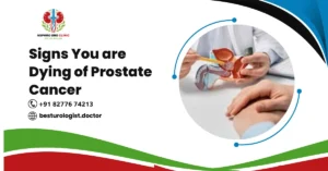 Signs You are Dying of Prostate Cancer