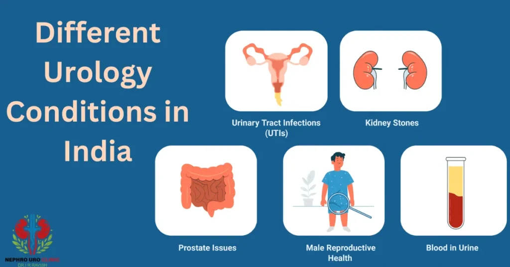 Best Urologist in India