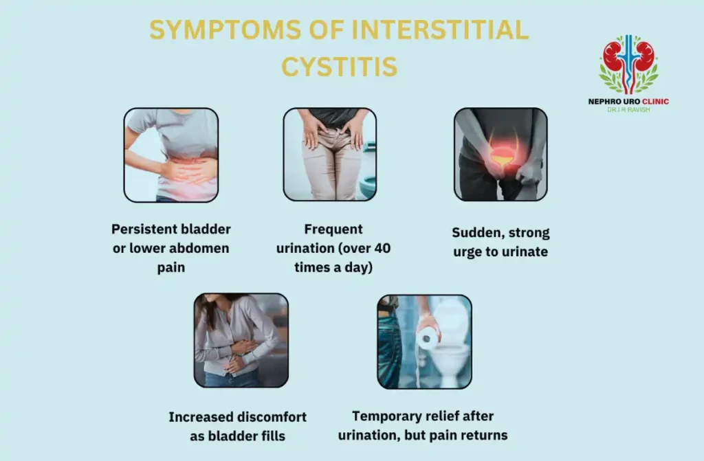 Bladder Pain Syndrome in Bangalore