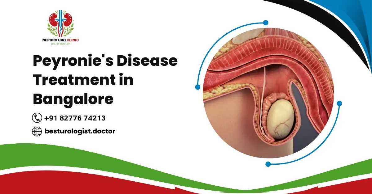Peyronie's Disease Treatment in Bangalore