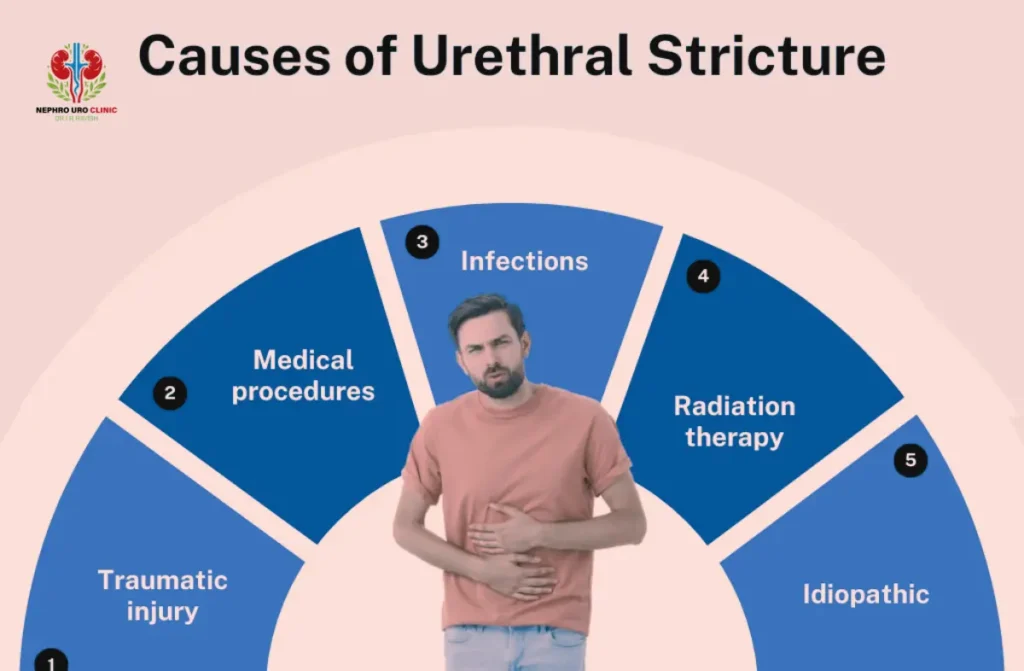 Urethral Stricture Treatment in Bangalore