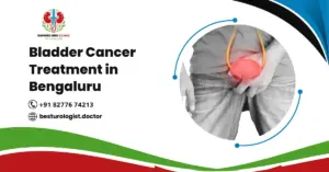 Bladder Cancer Treatment in Bengaluru