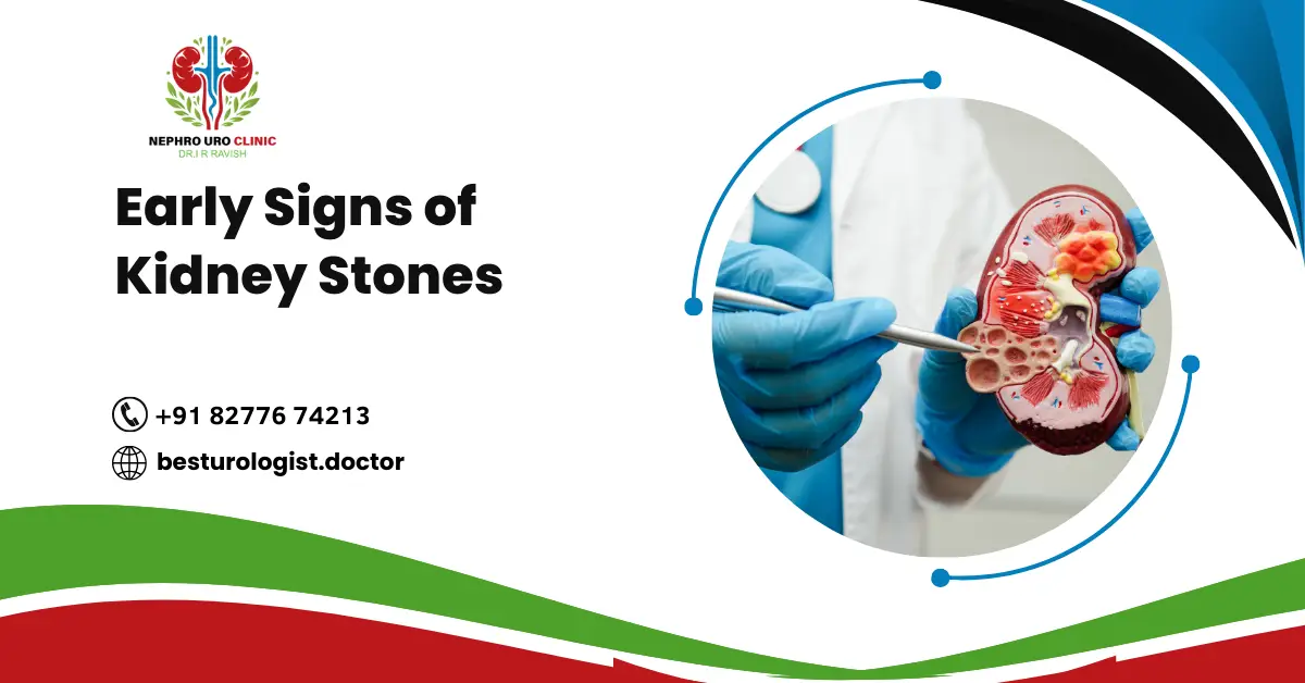 Early Signs of Kidney Stones