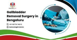 Gallbladder Removal Surgery in Bengaluru