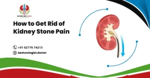 How to Get Rid of Kidney Stone Pain