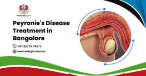 Peyronie's Disease Treatment in Bangalore