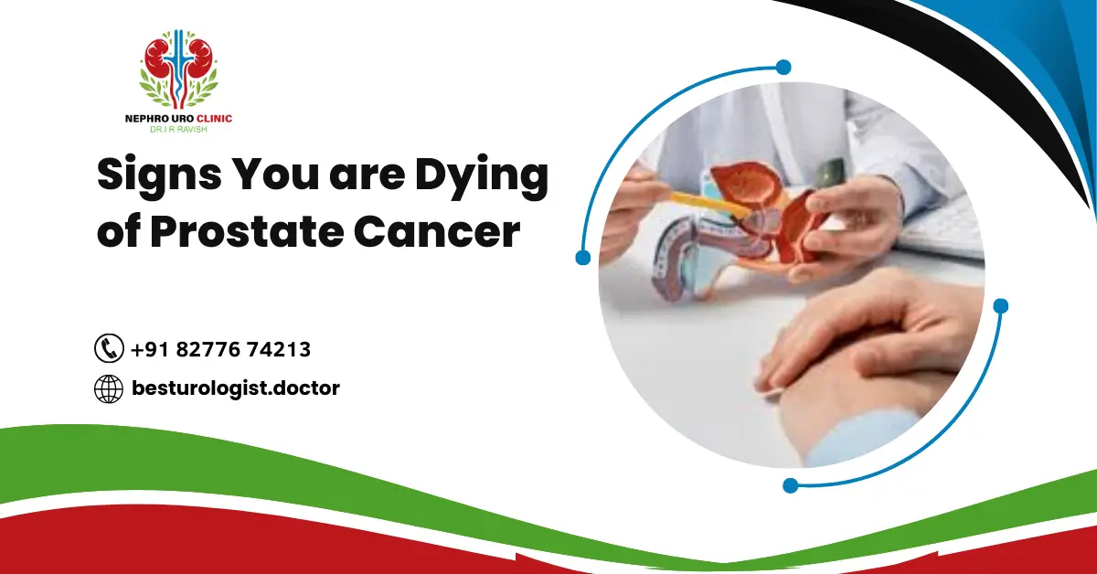 Signs You are Dying of Prostate Cancer