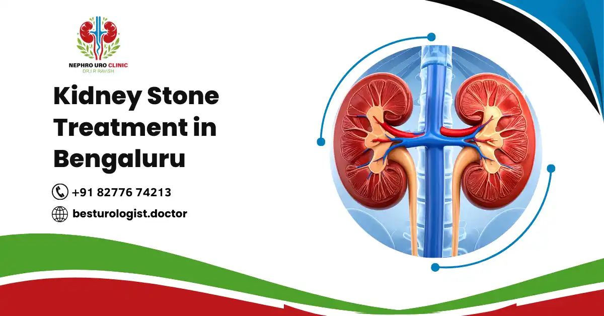 Kidney Stone treatment in Bengaluru | Best Urologist Doctor