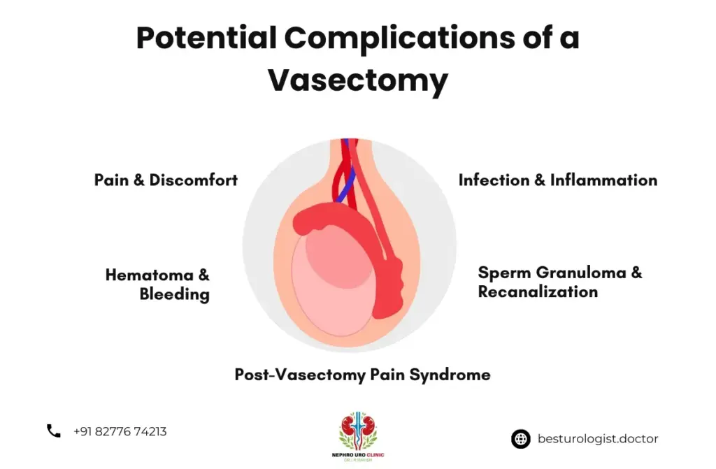 Complications of a vasectomy