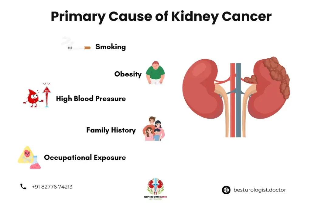 Treatment of Kidney Cancer