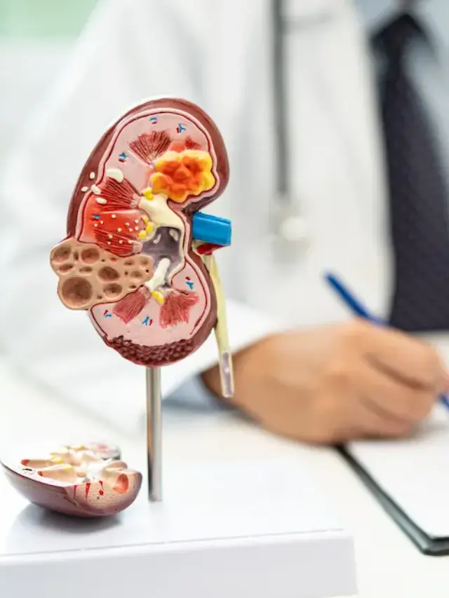 Early Signs of Kidney Stones