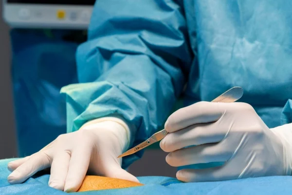 Minimally Invasive Endourology